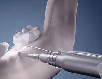 Jinme ES70/90 Surgical implant/Restoration Centre