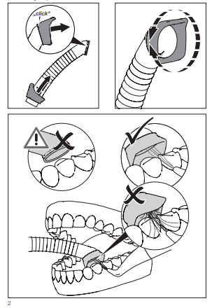 DURR Prophylaxis cannula