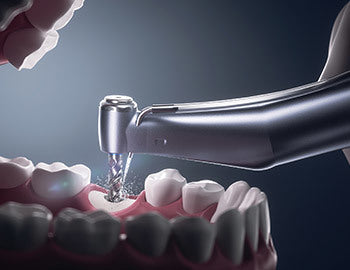 Jinme ES70/90 Surgical implant/Restoration Centre
